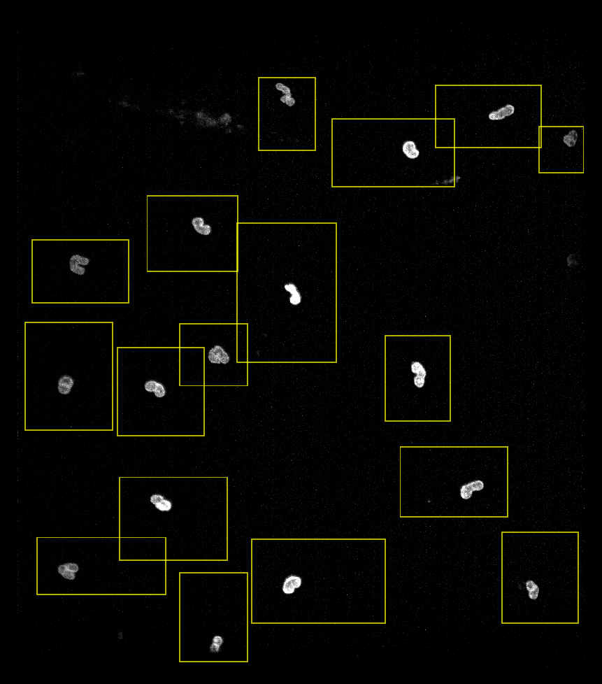 Deskewed neutrophil nuclei (single-timepoint max projection) with the imported cell ROIs overlaid as yellow rectangles