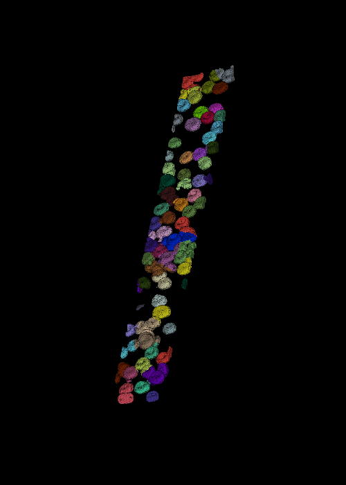 Segmentation result from the workflow